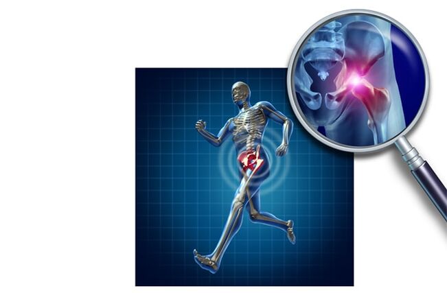 Болка при бягане в тазобедрената става